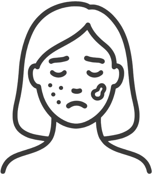 毛穴・ニキビ跡