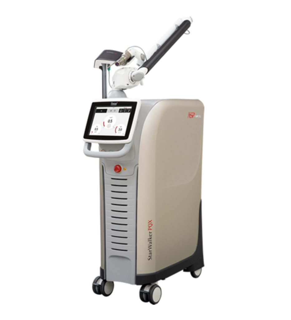 シミ取りレーザー